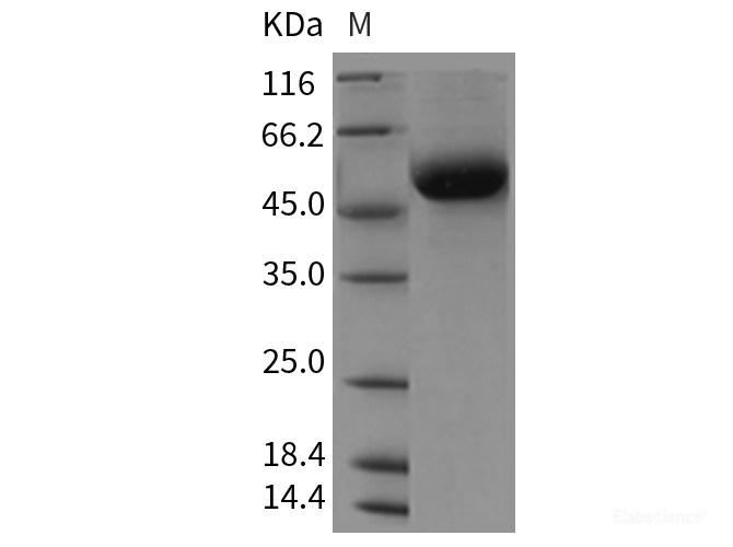 Recombinant Rat DDR1 Kinase / MCK10 / CD167 Protein (His tag)-Elabscience