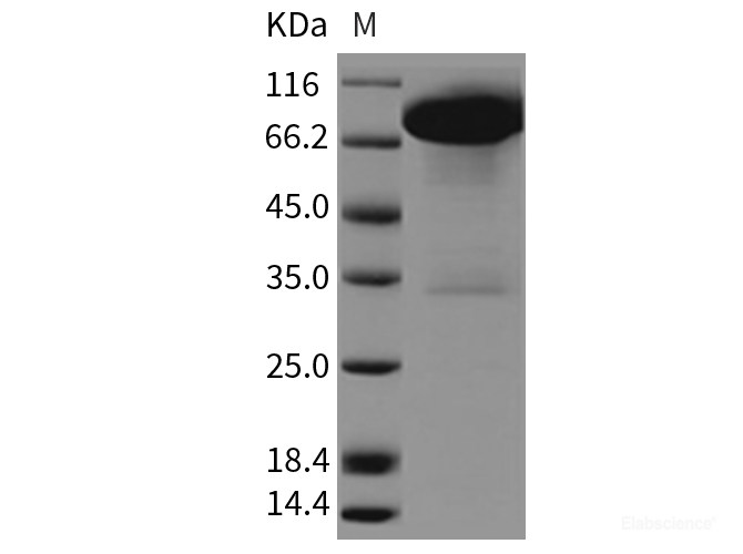Recombinant Rat DDR1 Kinase / MCK10 / CD167 Protein (Fc tag)-Elabscience