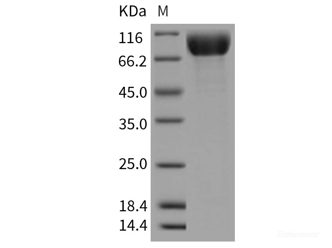 Recombinant Rat PDGFRa / CD140a Protein (His tag)-Elabscience