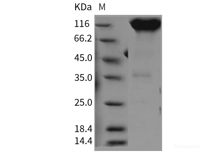 Recombinant Rat PDGFRa / CD140a Protein (Fc tag)-Elabscience