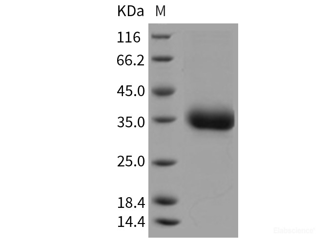 Recombinant Rat Layilin / LAYN Protein (His tag)-Elabscience