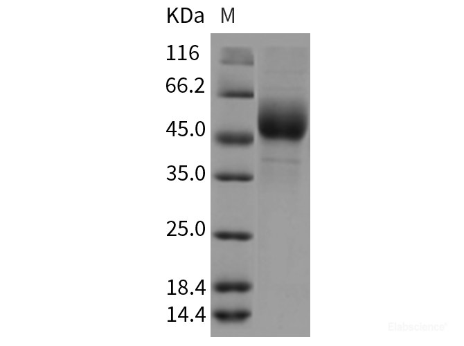 Recombinant Rat Ninjurin-1 / NINJ1 Protein (Fc tag)-Elabscience