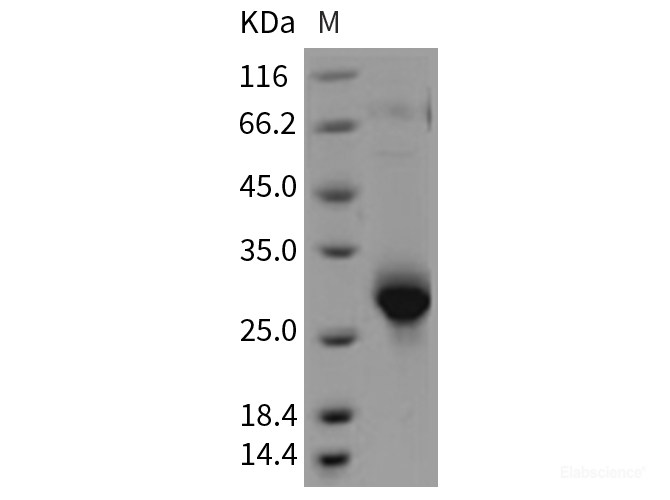 Recombinant Rat CLM-9 / TREM4 / CD300LG Protein (His tag)-Elabscience