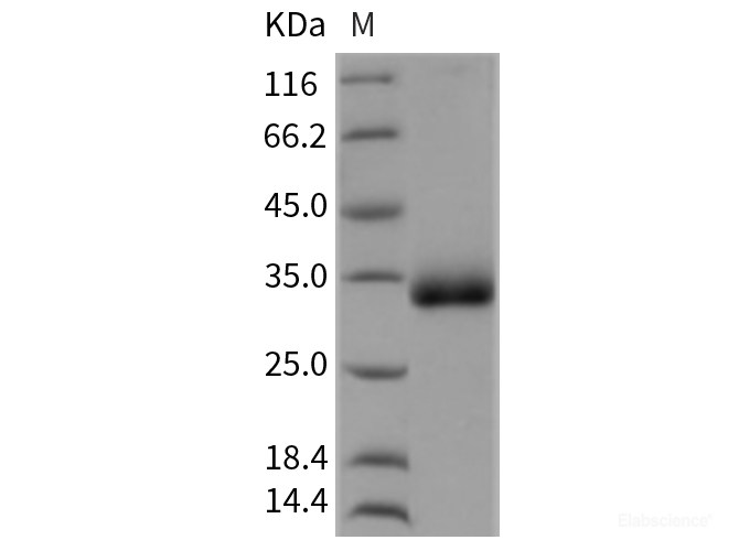 Recombinant Rat CHODL / Chondrolectin Protein (His tag)-Elabscience