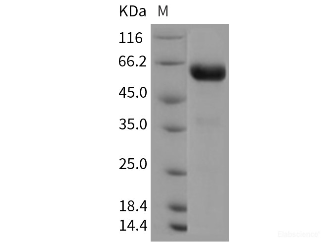 Recombinant Rat CHODL / Chondrolectin Protein (Fc tag)-Elabscience