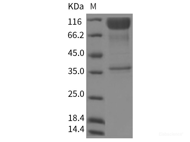 Recombinant Rat IL23R / IL23 Receptor Protein (Fc tag)-Elabscience