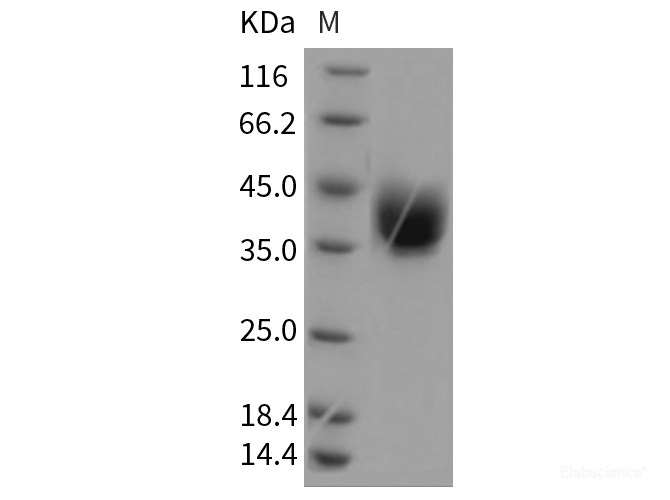 Recombinant Rat ART4 Protein (His tag)-Elabscience