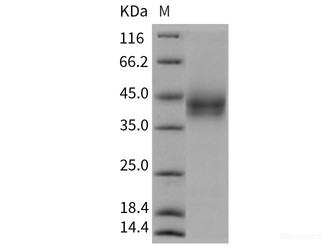 Recombinant Rat B7-H3 / CD276 Protein (His tag)-Elabscience