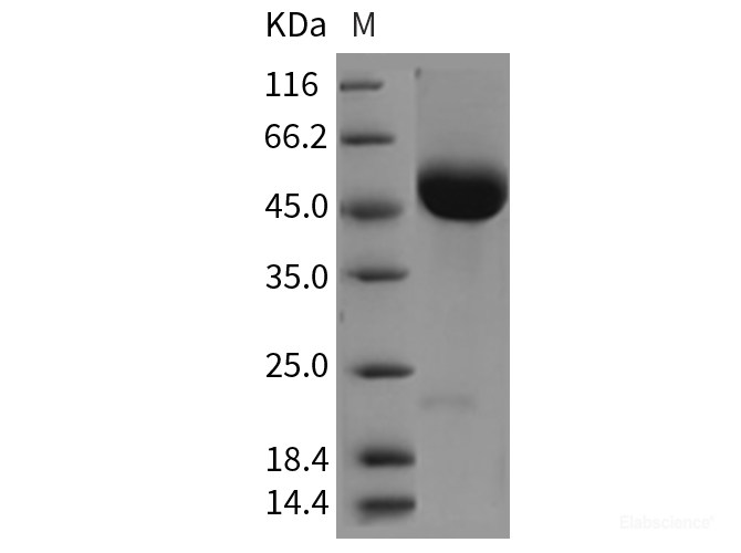 Recombinant Rat CD5 Protein (His tag)-Elabscience