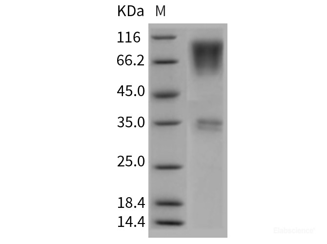 Recombinant Rat CD164 / Endolyn Protein (Fc tag)-Elabscience