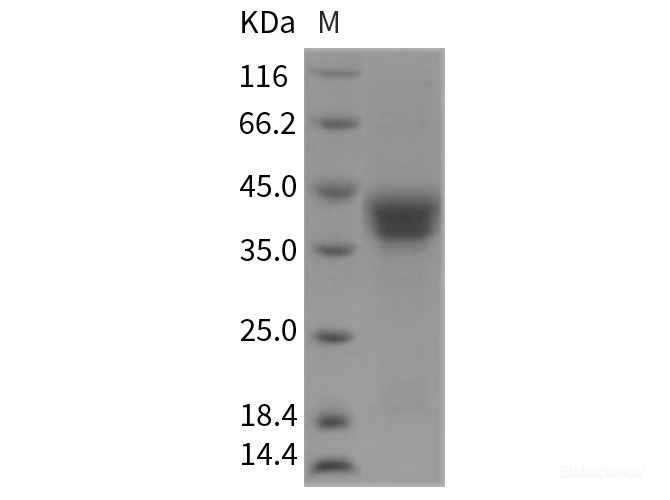 Recombinant Rat CD157 / BST1 Protein (His tag)-Elabscience