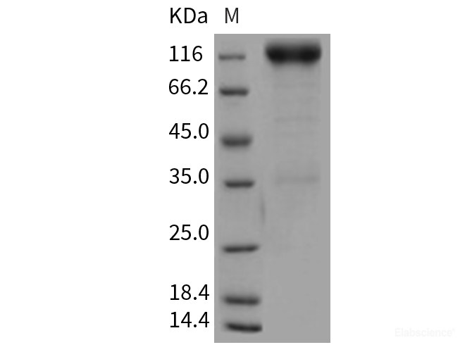 Recombinant Rat PDGFRB / PDGFR-1 Protein (Fc tag)-Elabscience