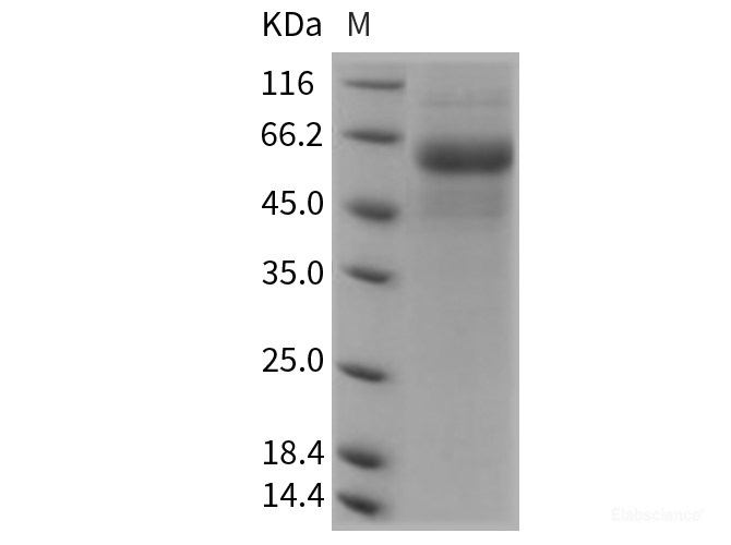 Recombinant Rat DDR2 Kinase / CD167b Protein (His tag)-Elabscience