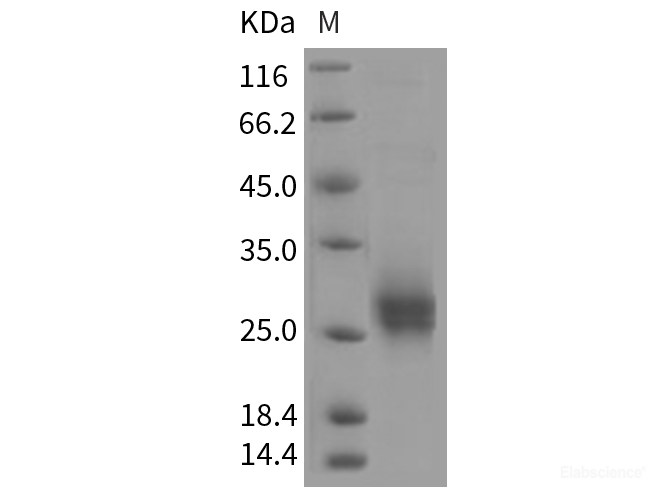 Recombinant Rat CD90 / THY-1 Protein (His tag)-Elabscience