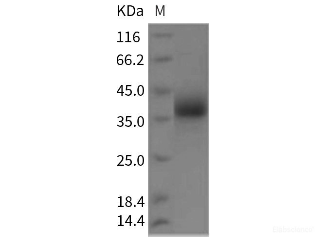 Recombinant Rat LILRA5 Protein (His tag)-Elabscience