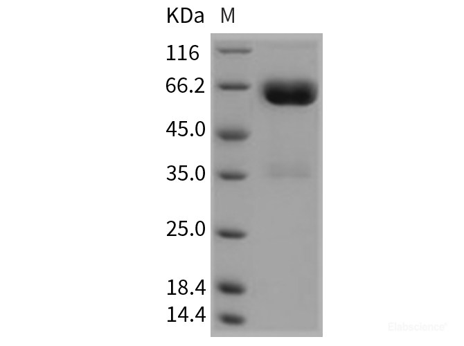 Recombinant Rat LILRA5 Protein (Fc tag)-Elabscience