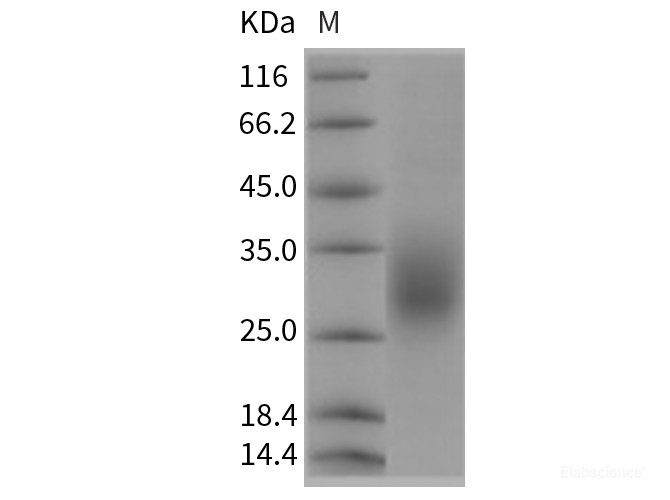 Recombinant Rat CD83 Protein (His tag)-Elabscience