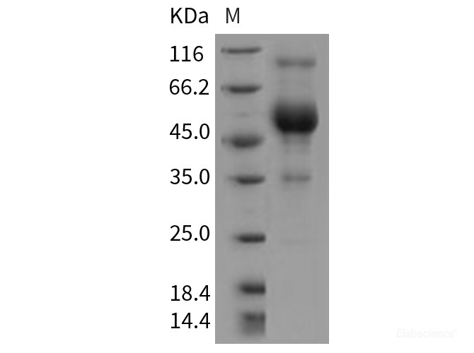 Recombinant Rat CD83 Protein (Fc tag)-Elabscience