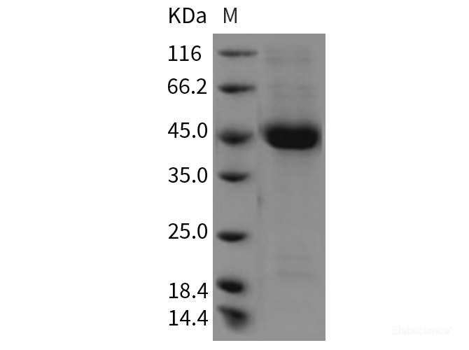 Recombinant Rat CD112 / Nectin-2 / PVRL2 Protein (His tag)-Elabscience