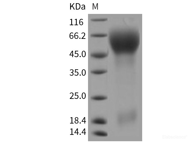Recombinant Rat CD133 / PROM1 / Prominin 1 Protein (His tag)-Elabscience