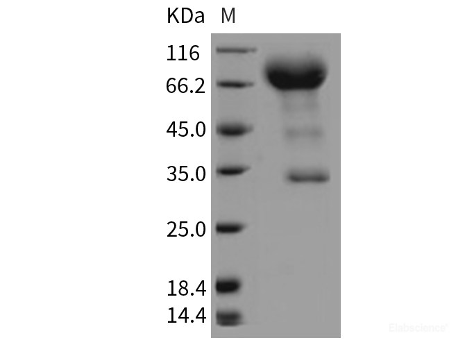 Recombinant Rat CD133 / PROM1 / Prominin 1 Protein (Fc tag)-Elabscience