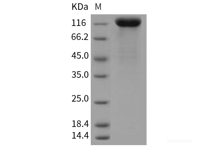 Recombinant Rat LIFR Protein (His tag)-Elabscience