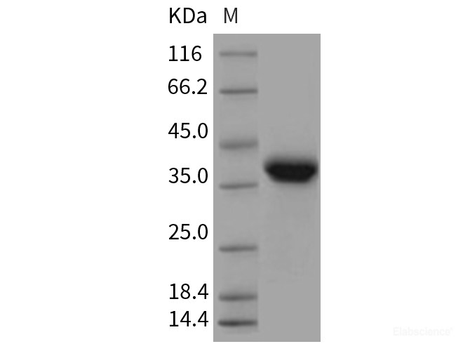 Recombinant Rat EpCAM / TROP-1 / TACSTD1 Protein (His tag)-Elabscience