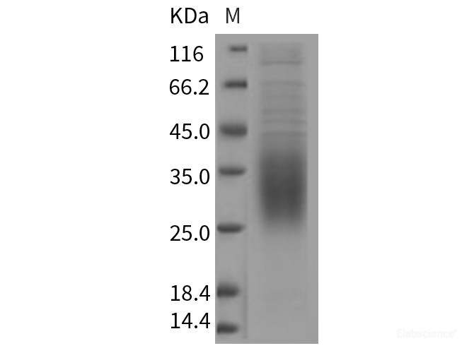 Recombinant Rat CD47 Protein (His tag)-Elabscience