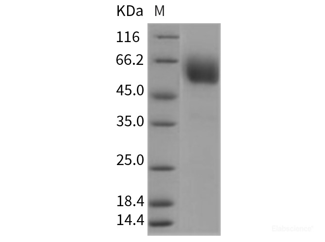 Recombinant Rat CD47 Protein (Fc tag)-Elabscience