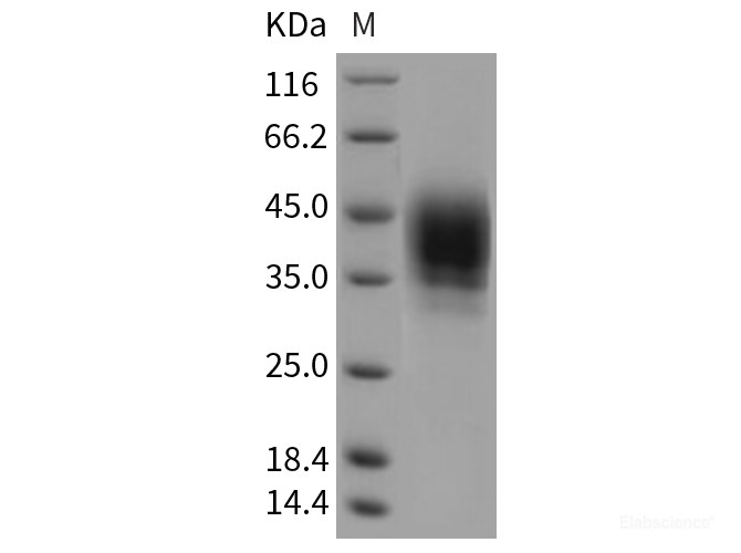 Recombinant Rat CD48 / SLAMF2 / BCM1 Protein (His tag)-Elabscience