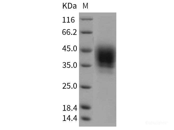 Recombinant Rat CD48 / SLAMF2 / BCM1 Protein (Fc tag)-Elabscience