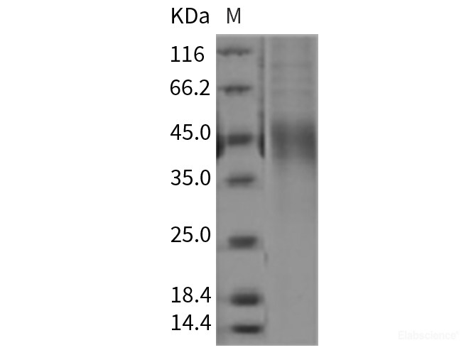 Recombinant Rat OLR1 / LOX1 Protein (His tag)-Elabscience