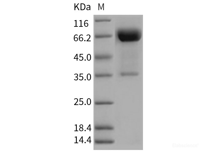 Recombinant Rat OLR1 / LOX1 Protein (Fc tag)-Elabscience