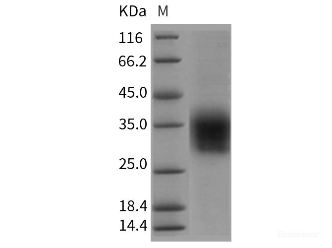 Recombinant Rat CLEC4A2 / DCIR Protein (His tag)-Elabscience
