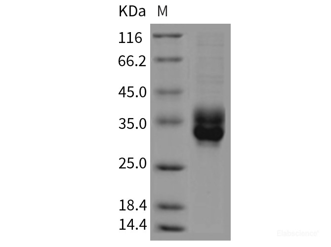 Recombinant Rat CLEC4B2 / mDCAR1 Protein (His tag)-Elabscience