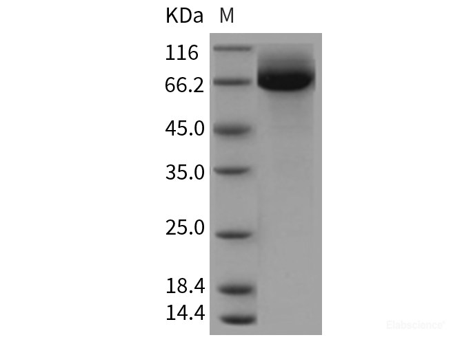 Recombinant Rat CD36 / SCARB3 Protein (His tag)-Elabscience