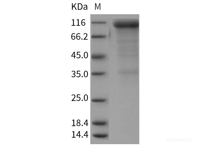 Recombinant Rat CD36 / SCARB3 Protein (Fc tag)-Elabscience