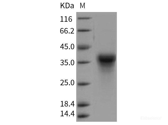 Recombinant Rat CLEC5A / MDL1 / MDL-1 Protein (His tag)-Elabscience