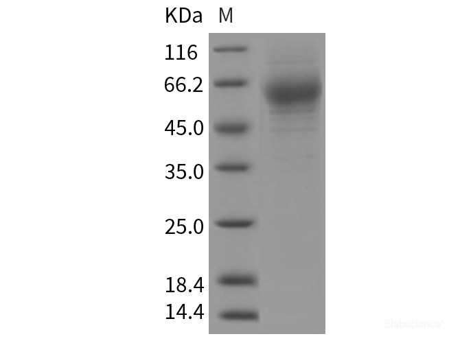 Recombinant Rat HepaCAM2 Protein (His tag)-Elabscience