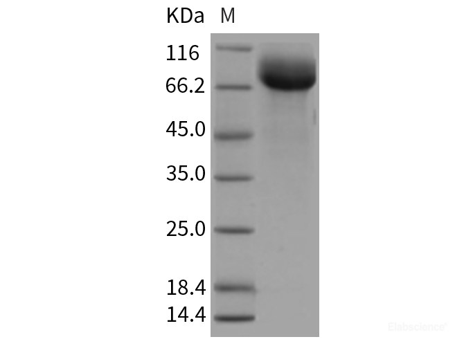 Recombinant Rat HepaCAM2 Protein (Fc tag)-Elabscience