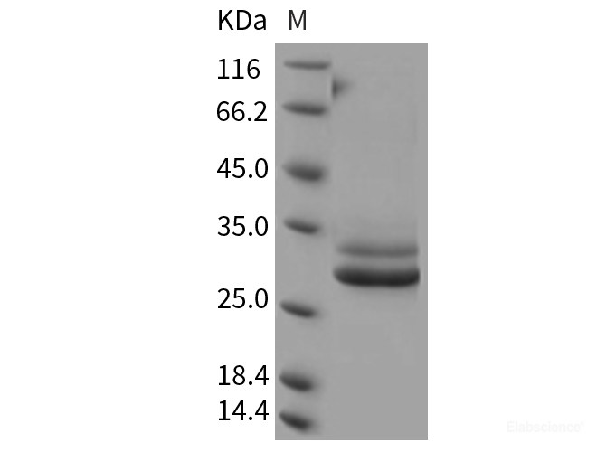 Recombinant Rat JAM-A / F11R Protein (His tag)-Elabscience