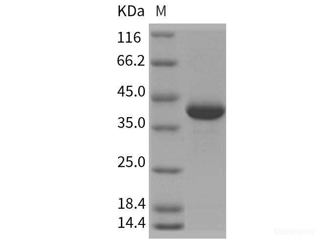 Recombinant Rat MDHA / MDH1 Protein (His tag)-Elabscience
