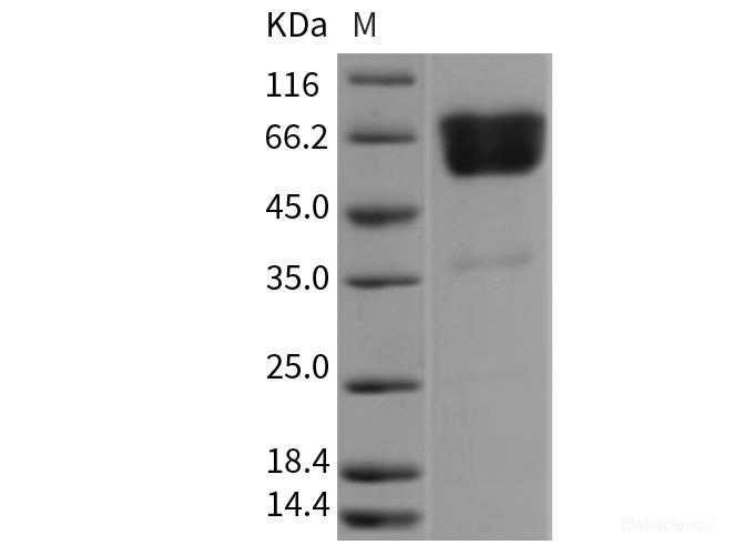 Recombinant Rat EDAR Protein (Fc tag)-Elabscience