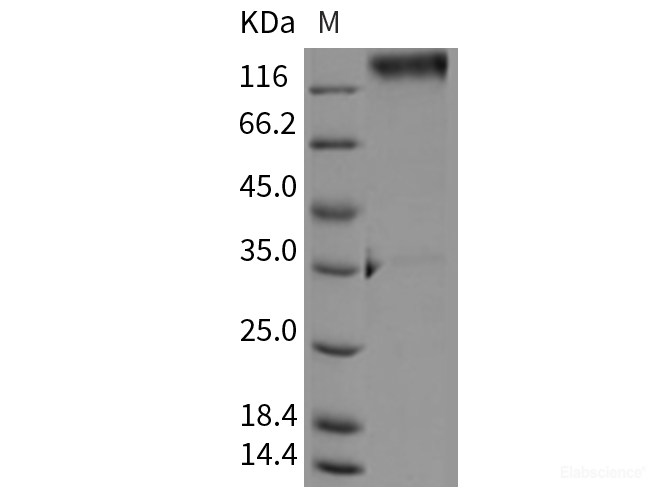 Recombinant Rat LAMP1 / CD107a Protein (Fc tag)-Elabscience