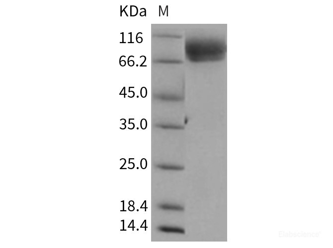 Recombinant Rat ALCAM / CD166 Protein (His tag)-Elabscience