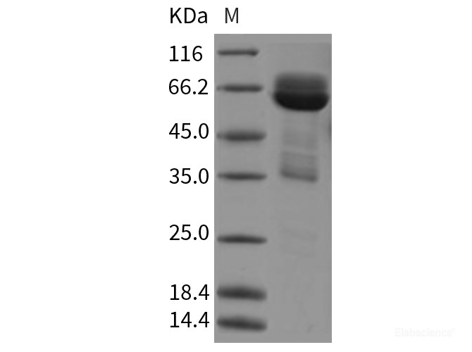 Recombinant Rat CADM3 / NECL1 / IGSF4B Protein (Fc tag)-Elabscience