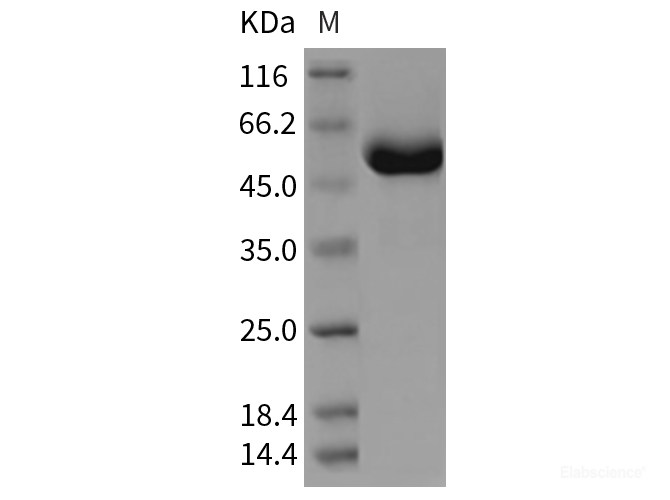 Recombinant Rat CLEC4D / CLECSF8 Protein (Fc tag)-Elabscience