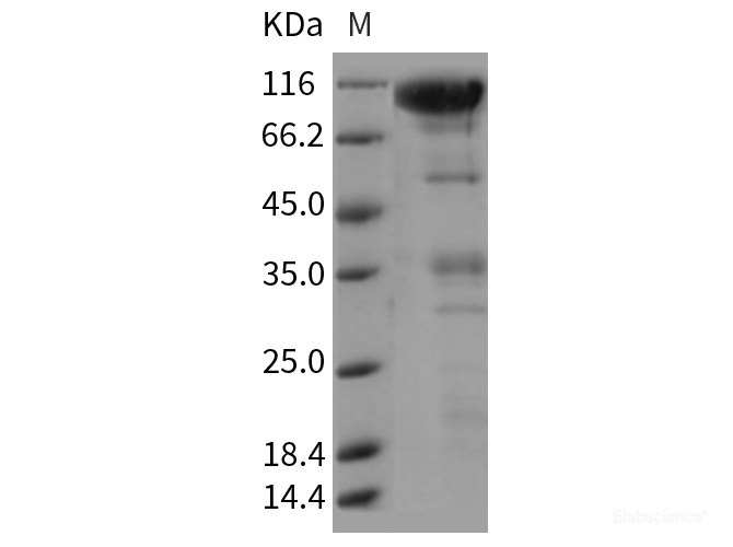 Recombinant Rat CLEC14A / EGFR-5 Protein (Fc tag)-Elabscience