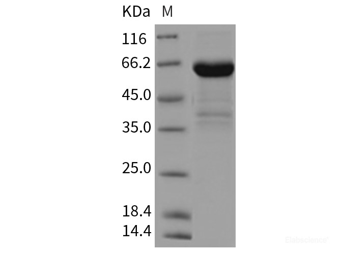 Recombinant Rat CD23 / FCER2 / FCER2A Protein (Fc tag)-Elabscience