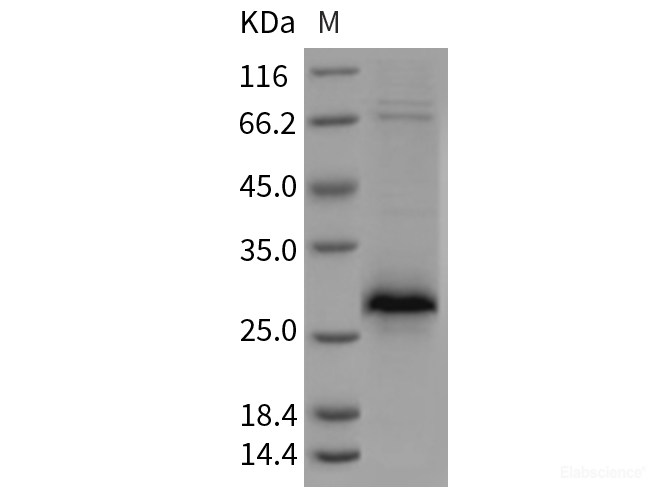 Recombinant Rat XEDAR / EDA2R Protein (His tag)-Elabscience
